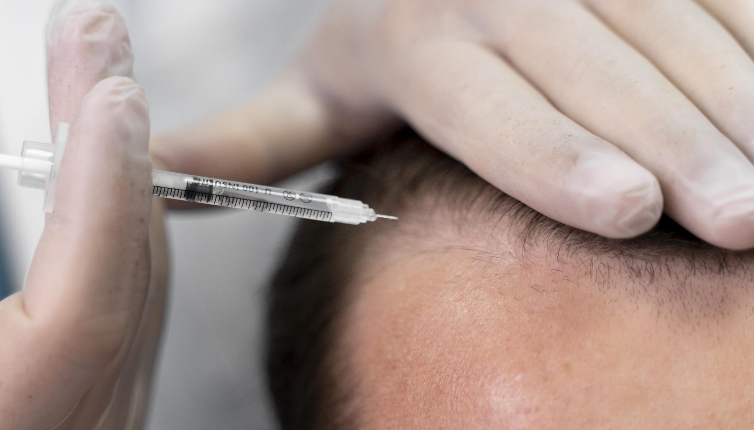 adult-male-doing-follicular-unit-